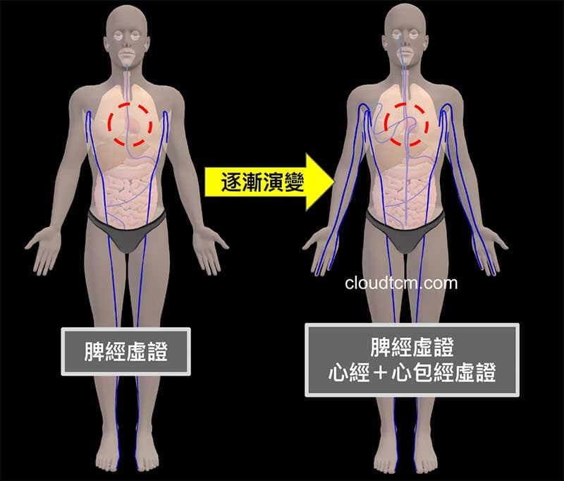 脾經虛證久了之後，會逐漸演變成心經心包經虛證