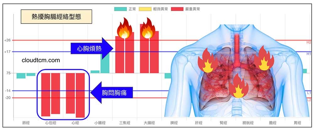 夏天容易出現熱擾胸膈的經絡型態