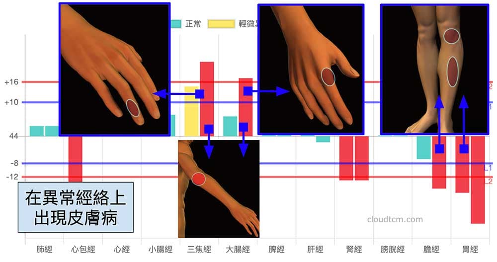 皮膚病經常出現在異常經絡上