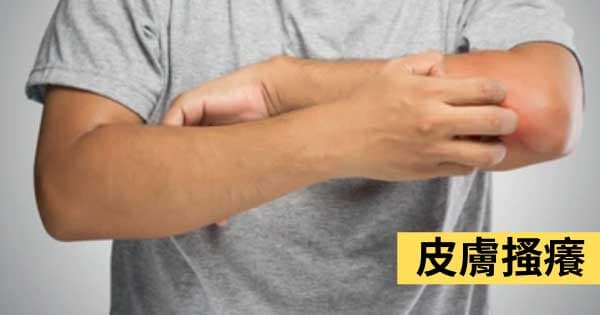 皮膚搔癢