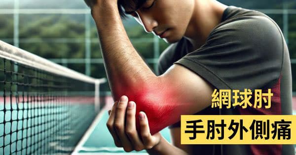 手肘外側痛