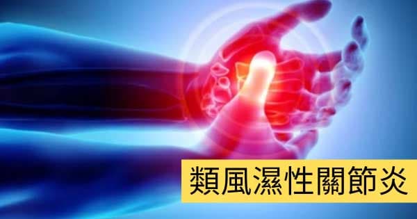 類風濕性關節炎