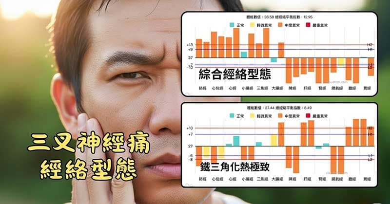 三叉神經痛常見經絡型態