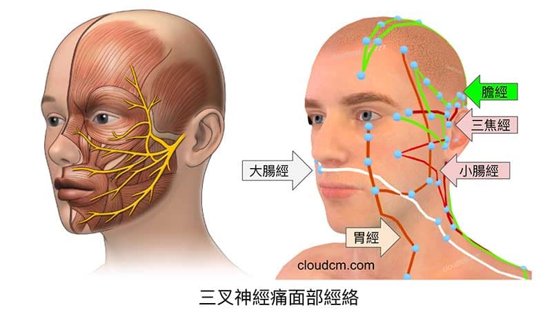 與三叉神經痛有關的經絡幾乎都是陽經