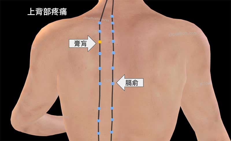 上背痛疼痛，可以拍打膏肓穴、膈俞穴