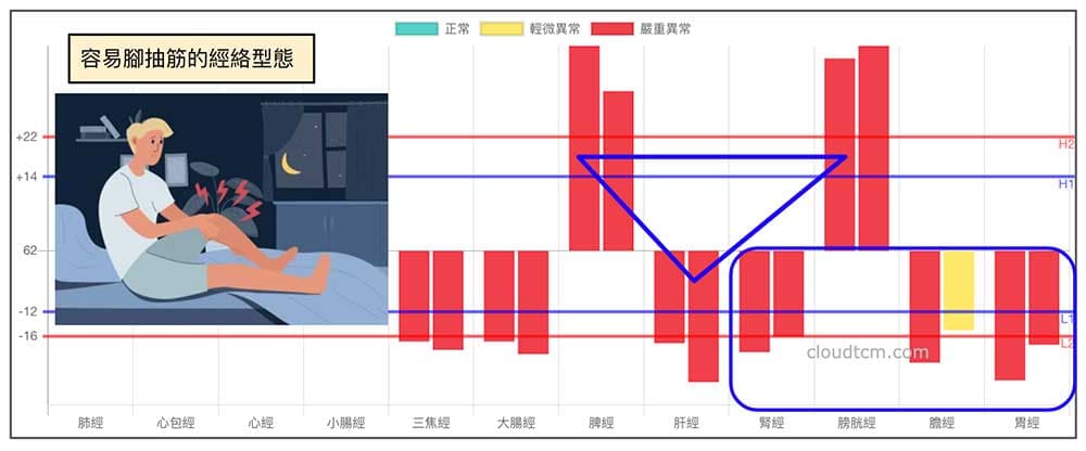 倒鐵三角經絡型態，容易出現小腿抽筋