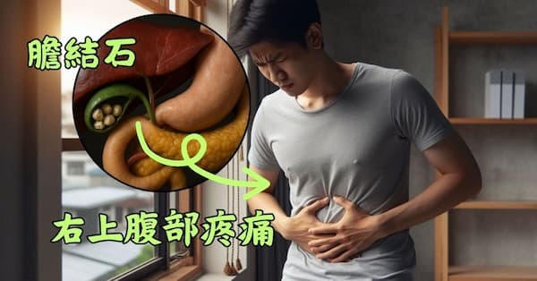 右上腹部劇烈疼痛時,有可能是膽結石
