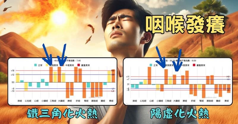 咽喉癢時,體內的經絡型態都是化火熱為主