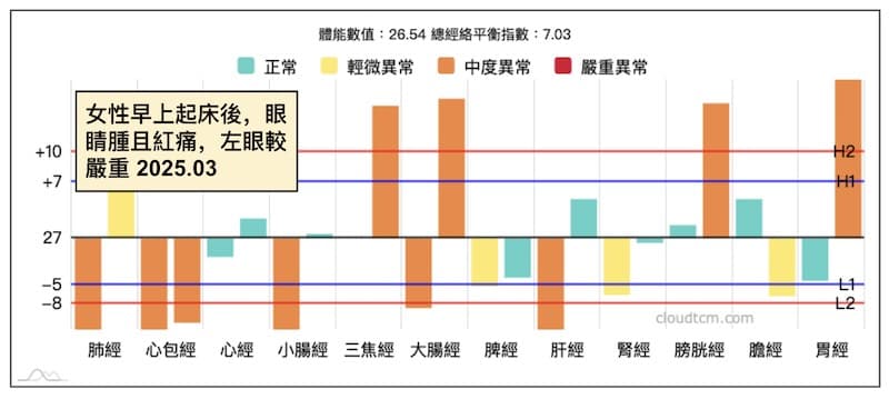女性在早上起床之後,出現眼睛紅痛現象