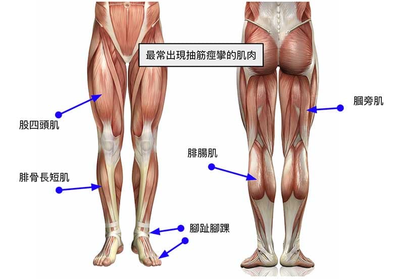 人體腳部最常出現抽筋痙攣的肌肉