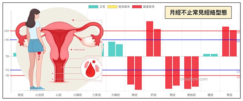 造成月經不止常見的經絡型態