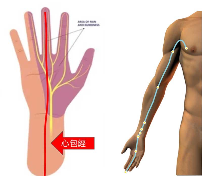心包經的運行路線，與正中神經重疊