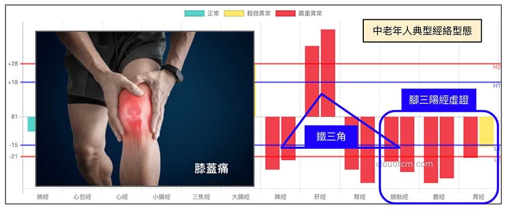 中老年人的經絡型態，難逃膝蓋痛