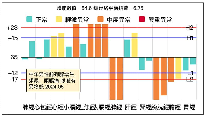 男性前列腺增生,容易頻尿