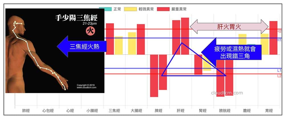 疲勞或天氣濕熱出現鐵三角