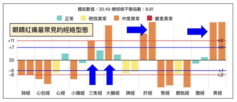 系統中,眼睛紅痛最常見的經絡型態