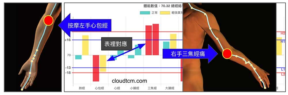 右手肘三焦經疼痛，可以在左手心包經上找痛點