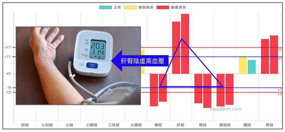 現代人肝腎陰虛經絡型態
