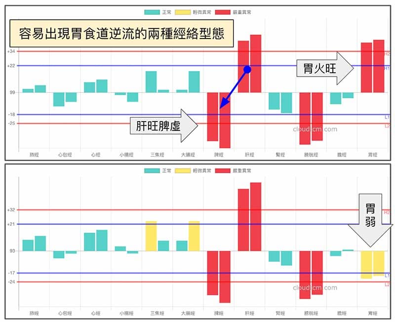 容易出現胃食道逆流的兩種肝氣犯胃經絡型態