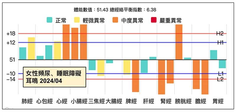 腎經虛證的人很容易頻尿