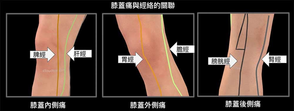 通過膝蓋的六條經絡，都有可能造成膝蓋疼痛