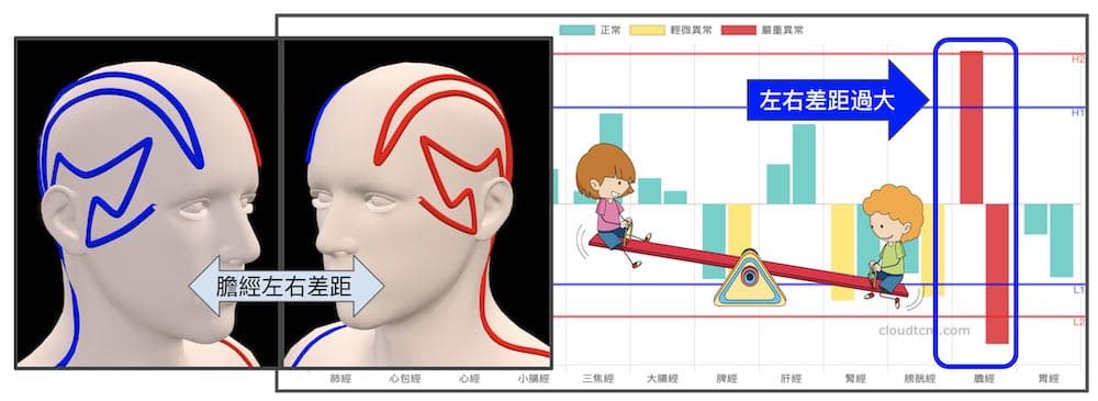 膽經左右能量差距過大,就像翹翹板左右不平衡造成頭暈