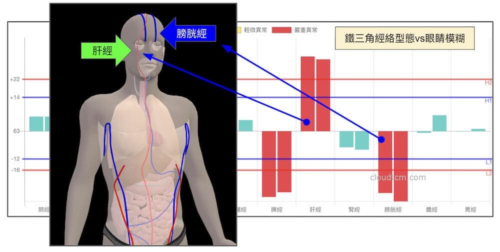 鐵三角經絡型態，容易出現眼睛模糊