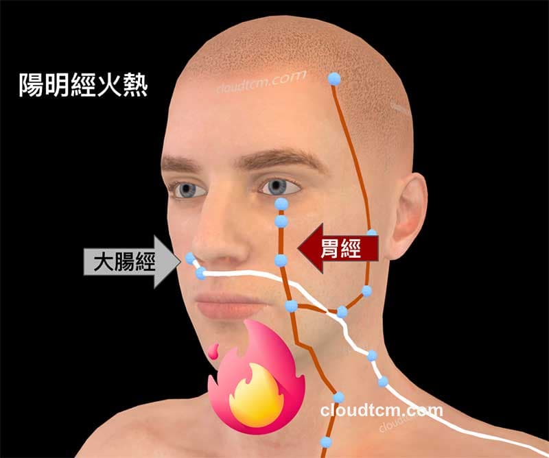 陽明經火熱時,很容易出現鼻子癢