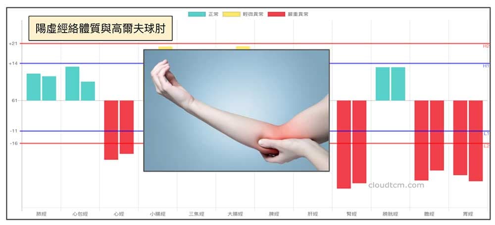 陽虛經絡體質的人,出現的疼痛難以根治
