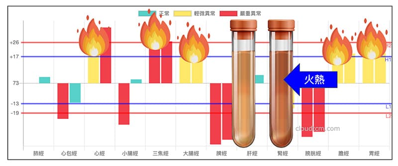 體內嚴重火熱,會出現血尿現象