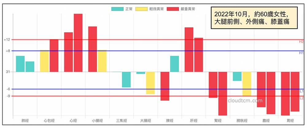 2022年10月60歲女性大腿前側、外側痛、膝蓋痛案例