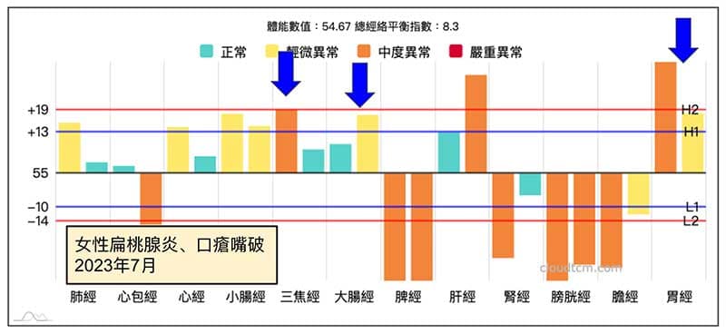 進入夏季之後出現慢性扁桃腺炎，三焦經大腸經實證