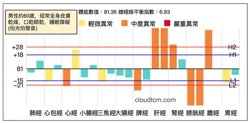 乾燥症候群案例