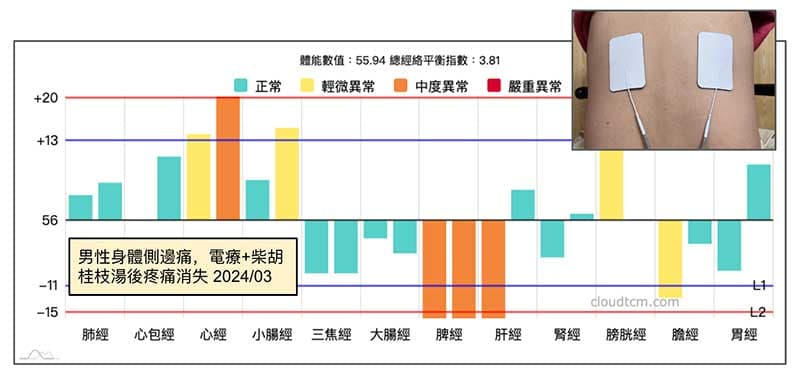 運用中藥及電療改善身體側邊痛