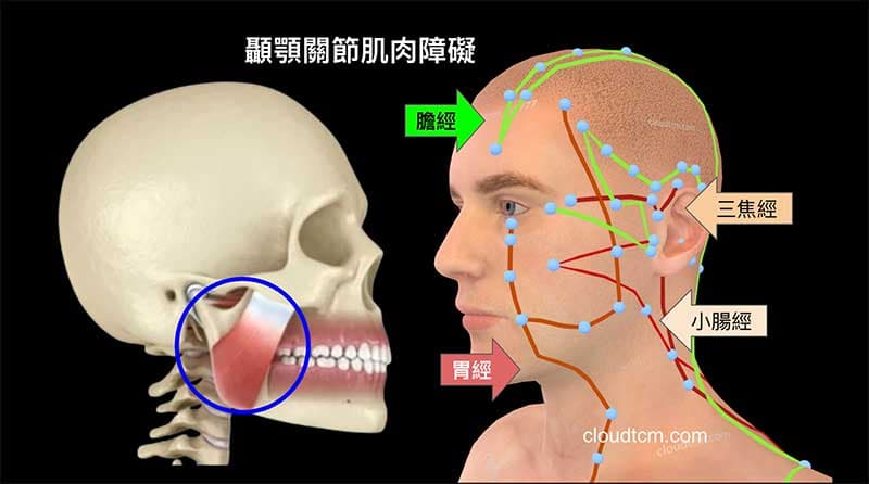 造成顳顎關節症候群的四條經絡(小腸經、三焦經、胃經與膽經)