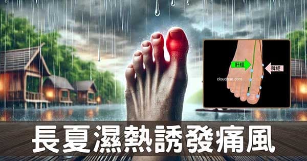 長夏季節誘發痛風,從經絡理解腳痛、大腳趾痛原因!