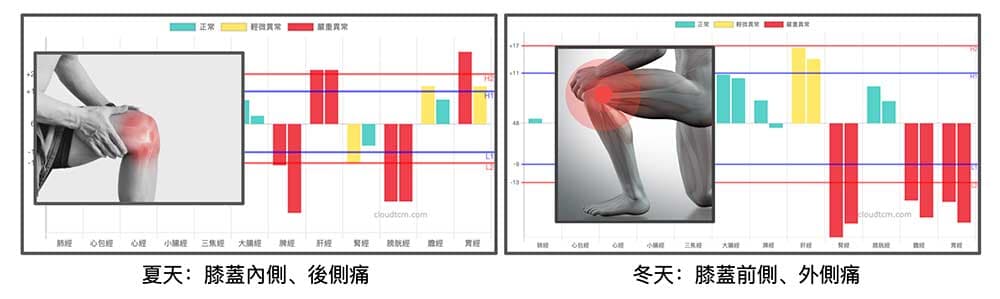 冬天與夏天的經絡型態不同，因此容易出現膝蓋痛的部位也不同