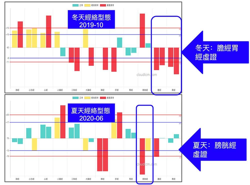 原本冬天的膽經胃經虛證經絡，到了夏天幾乎完全消失