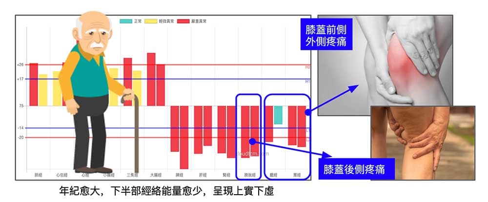 腳部三陽經的阻塞,造成膝蓋前側、外側與後側疼痛
