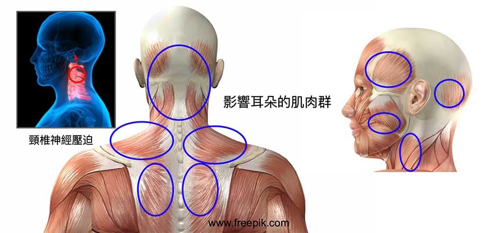 頭面部、頸部與背部的經肌肉頸椎都會影響到耳朵