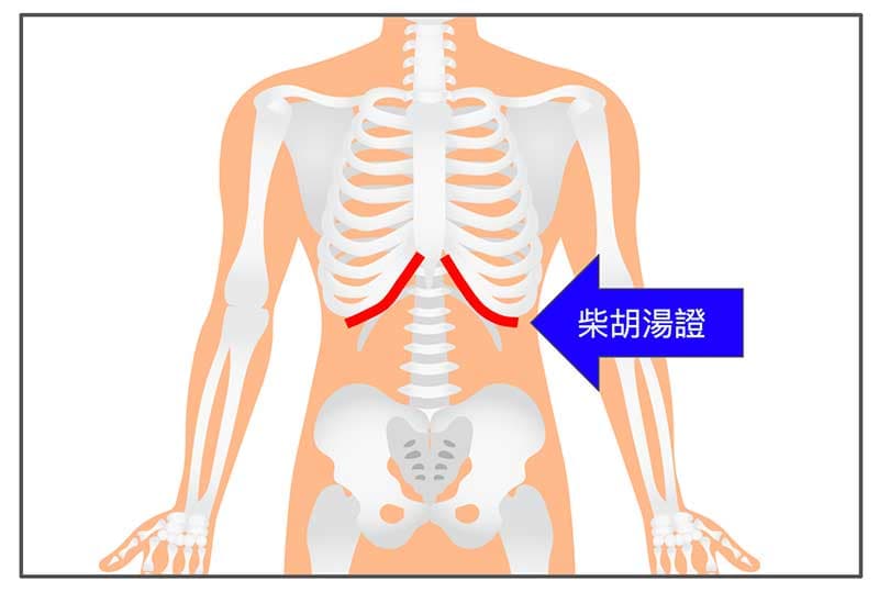 腹診透過揉按腹部的疼痛位置，來判斷開藥的方向
