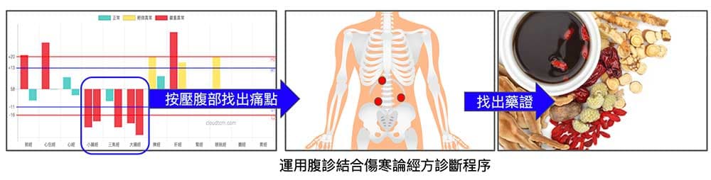 從經絡圖上看出腹部經絡阻塞，透過腹診進行診斷程序