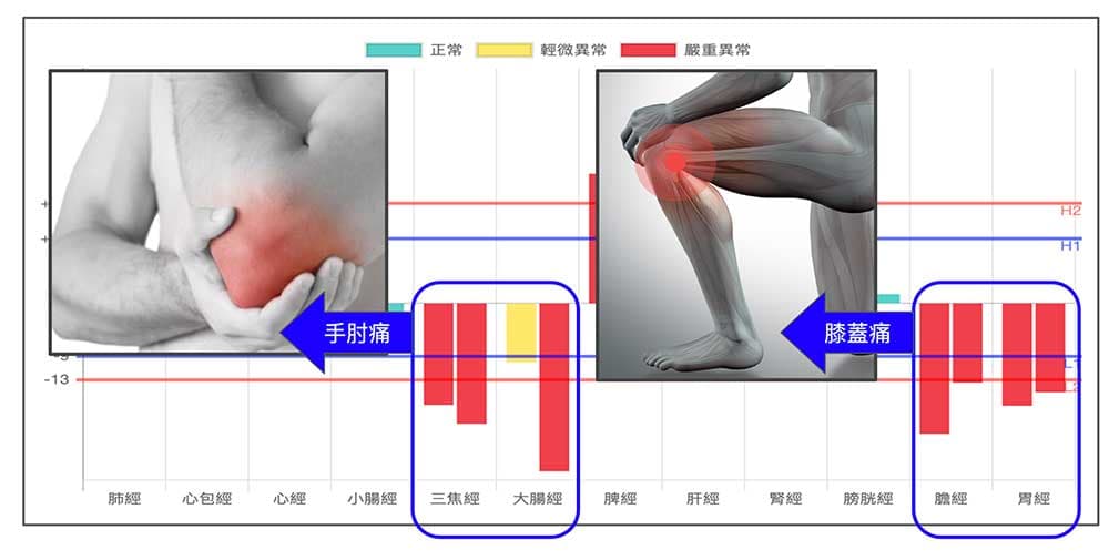 體內陽虛經絡型態，造成膝蓋與手肘痛