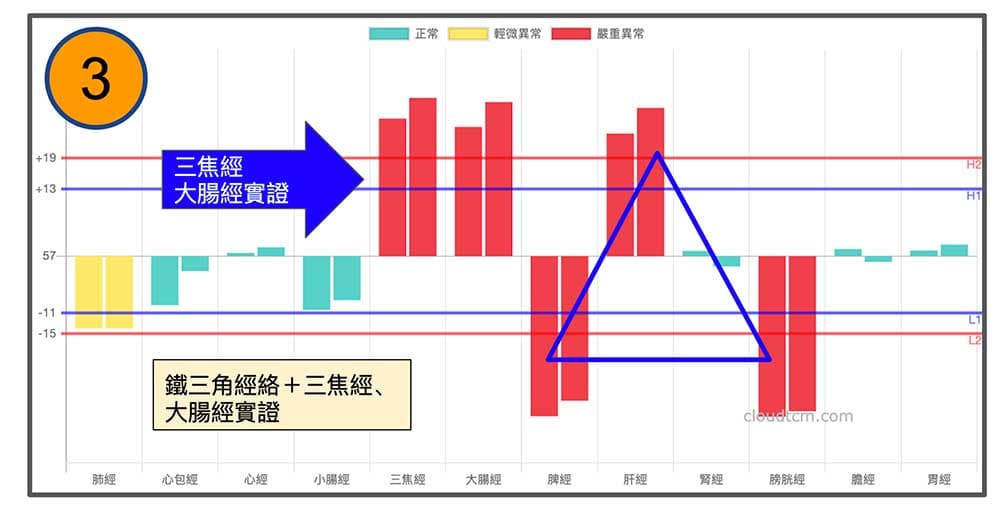 春夏之後體內火氣上升，鐵三角經絡組合加上三焦經、大腸經實證