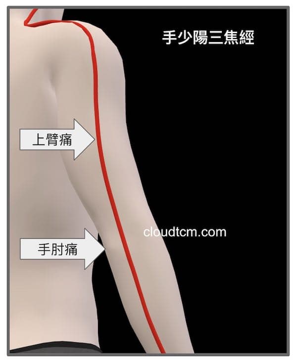 三焦經異常出現手肘痛、上臂痛