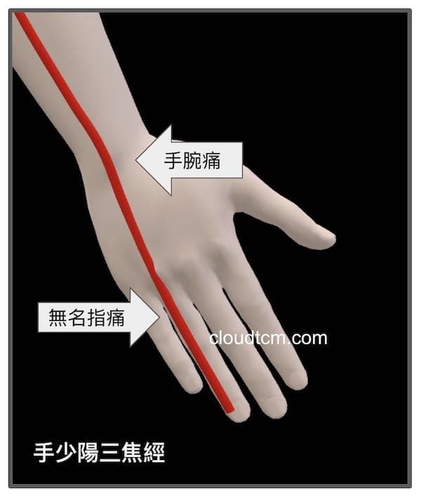 三焦經異常時，無名指與手腕會出現疼痛