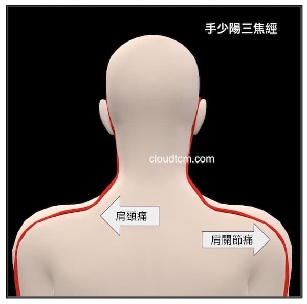 三焦經異常時，最容易出現肩頸痛