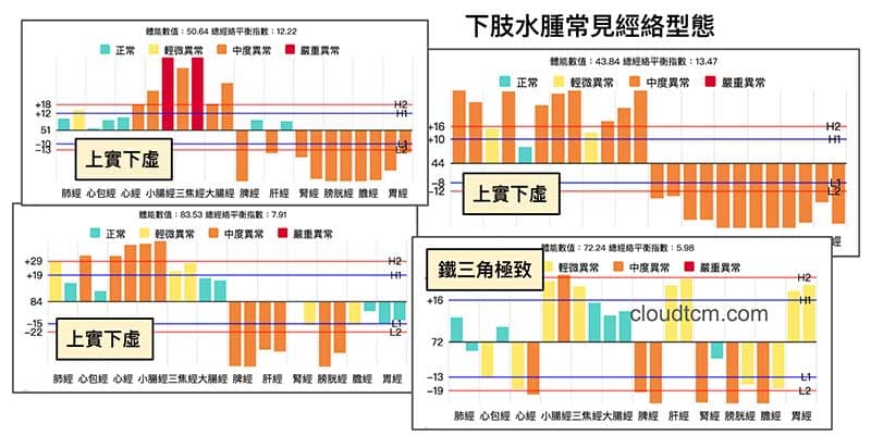 上實下虛經絡型態,很容易出現下肢水腫
