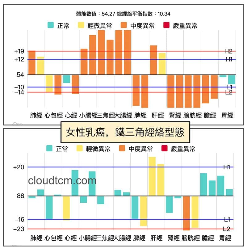 鐵三角經絡型態的乳癌案例