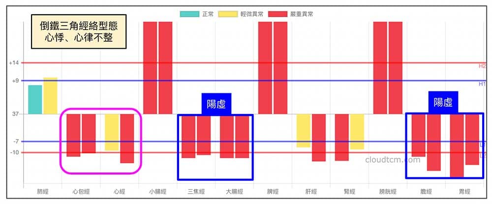 倒鐵三角經絡型態也容易出現心悸與心律不整